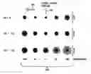 Fig. 01 - Presbyopia correction through negative high-order spherical aberration