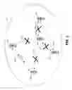 Fig. 04 - Recovery techniques for wireless communications networks