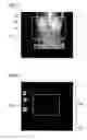 Fig. 02 - Method for automatically setting and reconstructing the field of view along the inner boundaries of the thorax on a CT topogram
