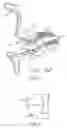 Fig. 02 - Hearing aid battery barrier