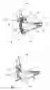 Fig. 02 - In-ear device