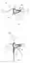 Fig. 03 - In-ear device