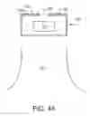 Fig. 04 - Hearing aid microphone protective barrier
