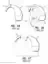 Fig. 02 - In the ear auxiliary microphone for behind the ear hearing prosthetic
