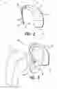 Fig. 03 - In the ear auxiliary microphone for behind the ear hearing prosthetic