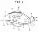 Fig. 02 - Headphone device