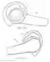 Fig. 07 - Porous solid wind screen for microphone