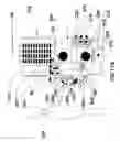 Fig. 20 - Remote diagnostic device for medical testing
