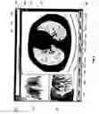 Fig. 06 - Graphical user interface for display of anatomical information