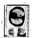 Fig. 10 - Graphical user interface for display of anatomical information