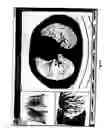 Fig. 12 - Graphical user interface for display of anatomical information