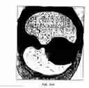 Fig. 16 - Graphical user interface for display of anatomical information