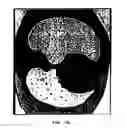 Fig. 17 - Graphical user interface for display of anatomical information