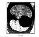 Fig. 19 - Graphical user interface for display of anatomical information