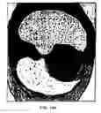 Fig. 20 - Graphical user interface for display of anatomical information