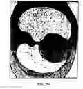 Fig. 23 - Graphical user interface for display of anatomical information