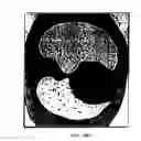 Fig. 24 - Graphical user interface for display of anatomical information