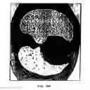 Fig. 25 - Graphical user interface for display of anatomical information