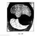 Fig. 26 - Graphical user interface for display of anatomical information