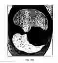 Fig. 27 - Graphical user interface for display of anatomical information