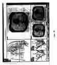 Fig. 33 - Graphical user interface for display of anatomical information