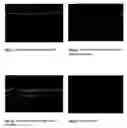 Fig. 02 - Vectorization of dsRNA by cationic particles and use of same on a skin model