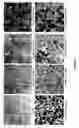 Fig. 05 - Vectorization of dsRNA by cationic particles and use of same on a skin model