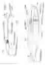 Fig. 08 - Intracoronary device and method of use thereof