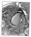 Fig. 02 - Generating teeth from bone marrow cells