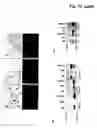Fig. 16 - Cross-beta structure comprising amyloid binding proteins and methods for detection of the cross-beta structure, for modulating cross-beta structures fibril formation and for modulating cross-beta structure-mediated toxicity and method for interfering with blood coagulation