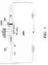 Fig. 02 - VARIABLE HEAVY CHAIN AND VARIABLE LIGHT CHAIN REGIONS OF ANTIBODIES TO HUMAN PLATELET GLYCOPROTEIN IB ALPHA