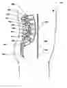 Fig. 01 - Osteogenic implants for soft tissue