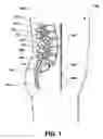 Fig. 02 - Osteogenic implants for soft tissue