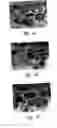 Fig. 07 - Anti-angiogenic compositions and methods of use