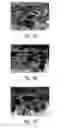 Fig. 07 - Anti-angiogenic compositions and methods of use