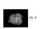 Fig. 03 - Enhanced filamentous silicone products and processes
