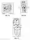 Fig. 09 - Systems and methods for providing orthodontic outcome evaluation