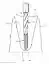 Fig. 01 - Method and drill bit for extracting a root of a tooth