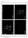 Fig. 14 - Artificial mammalian chromosome