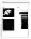 Fig. 17 - Artificial mammalian chromosome