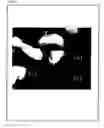 Fig. 18 - Artificial mammalian chromosome
