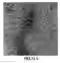 Fig. 05 - Low dislocation density group III nitride layers on silicon carbide substrates and methods of making the same