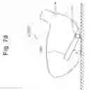 Fig. 20 - Head assembly of golf club