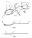Fig. 02 - Apparatus and method for tennis swing training