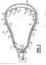Fig. 02 - Offset lacrosse head