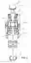 Fig. 03 - Joint alignment and compression assembly and method for performing a rehabilitative treatment regimen