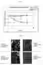 Fig. 07 - Compositions and methods for treating or preventing overweight or obesity with zinc-charged protein fragments
