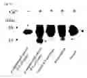 Fig. 09 - Method of degrading transcriptional factors of saccharometabolism-associated gene, method for inhibiting the degradation, and agent for inhibiting degradation and degradation inhibitor
