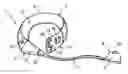 Fig. 01 - Adjustable gastroplasty ring comprising a grip tab