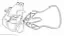 Fig. 01 - Clip and method for epicardial placement of temporary heart pacing electrodes